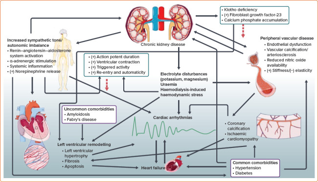 Arrhythmias in Chronic Kidney Disease.