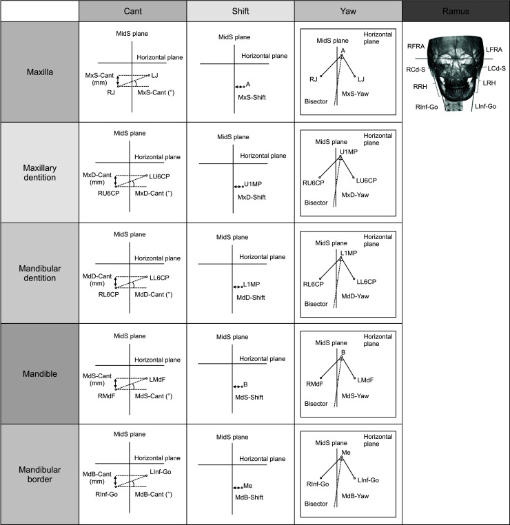 Characterization of facial asymmetry phenotypes in adult patients with skeletal Class III malocclusion using three-dimensional computed tomography and cluster analysis.