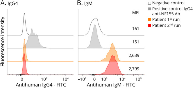 Combined Central and Peripheral Demyelination With IgM Anti-Neurofascin 155 Antibodies: Case Report.
