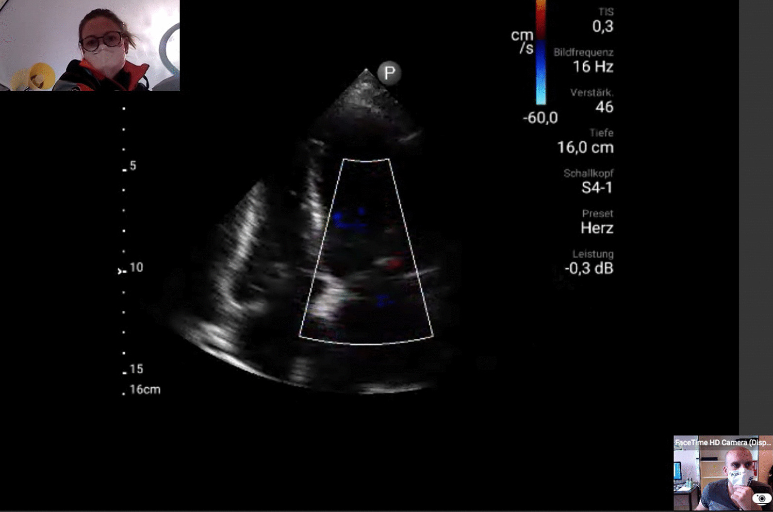 Remote real-time supervision of prehospital point-of-care ultrasound: a feasibility study.