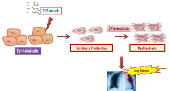 Physiopathological Mechanisms Involved in the Progression of Pulmonary Fibrosis: A Systematic Review.