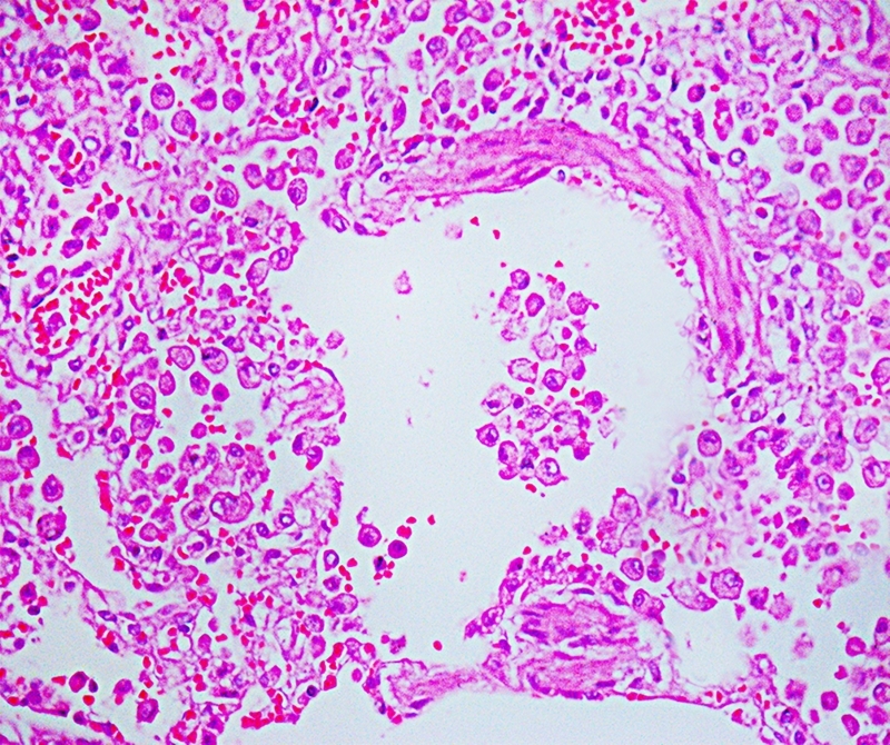 Persistent SARS-CoV-2 antigen presence in multiple organs of a naturally infected cat from Brazil.