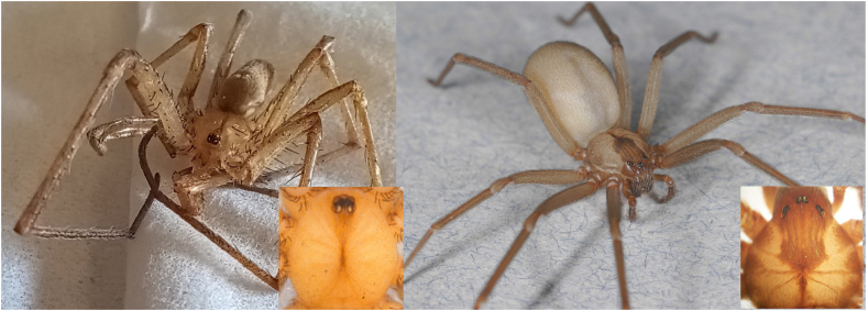 Verified envenomations by crevice weaver spiders (genus Kukulcania): Bites are of minor expression but the spiders are commonly misidentified as medically important brown recluses (genus Loxosceles) in North America