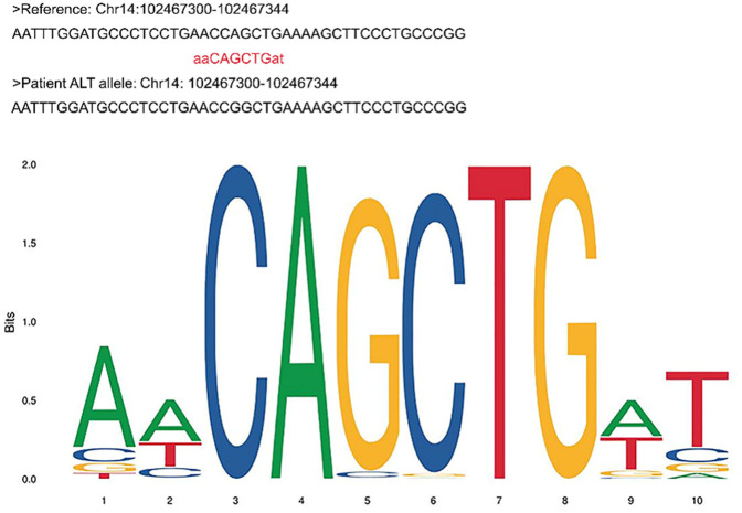 A novel variant in <i>DYNC1H1</i> could contribute to human amyotrophic lateral sclerosis-frontotemporal dementia spectrum.