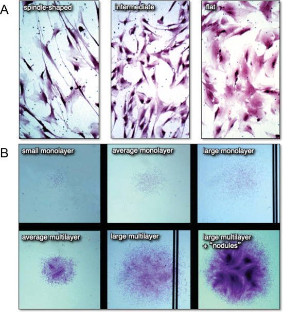 Recent updates on the biological basis of heterogeneity in bone marrow stromal cells/skeletal stem cells.