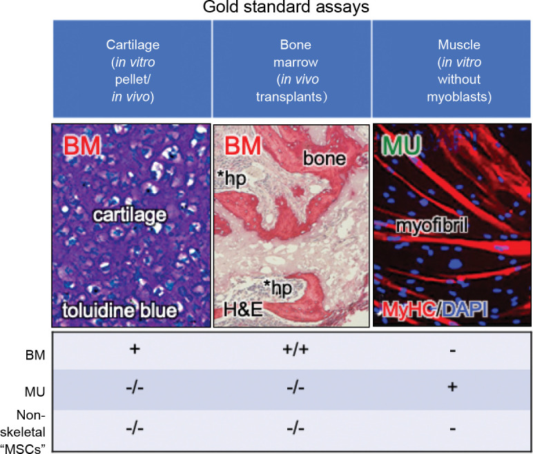 Recent updates on the biological basis of heterogeneity in bone marrow stromal cells/skeletal stem cells.