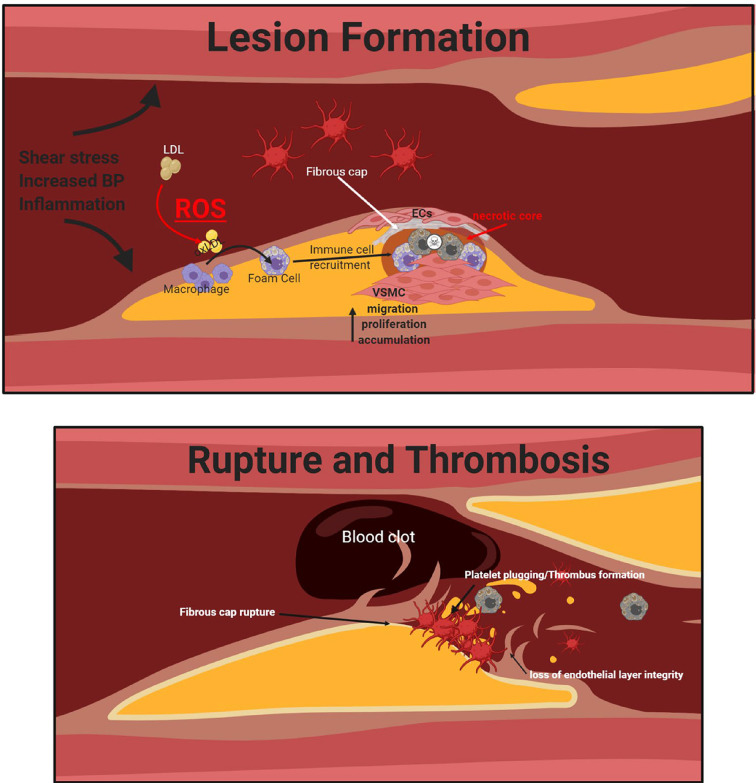 Chronic obstructive pulmonary disease and atherosclerosis: common mechanisms and novel therapeutics.