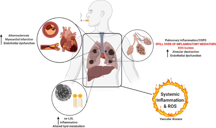 Chronic obstructive pulmonary disease and atherosclerosis: common mechanisms and novel therapeutics.