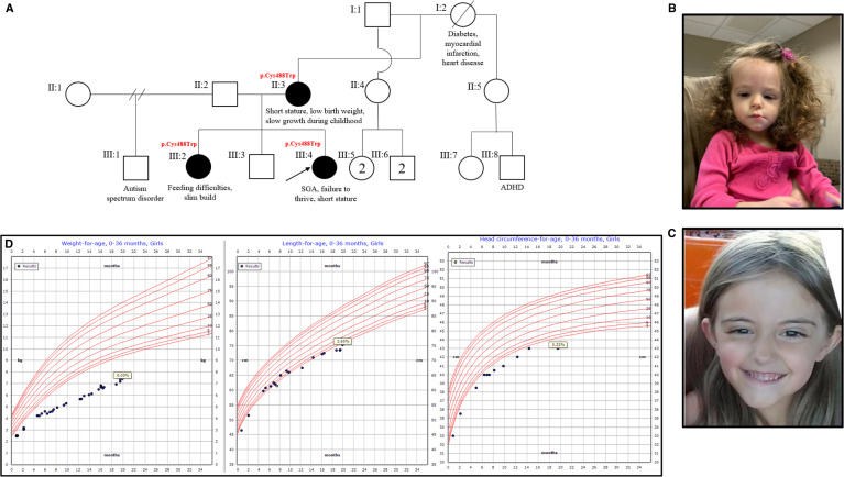 Reanalysis of a novel variant in the <i>IGF1R</i> gene in a family with variable prenatal and postnatal growth retardation and dysmorphic features: benefits and feasibility of IUSM-URDC (Undiagnosed Rare Disease Clinic) program.