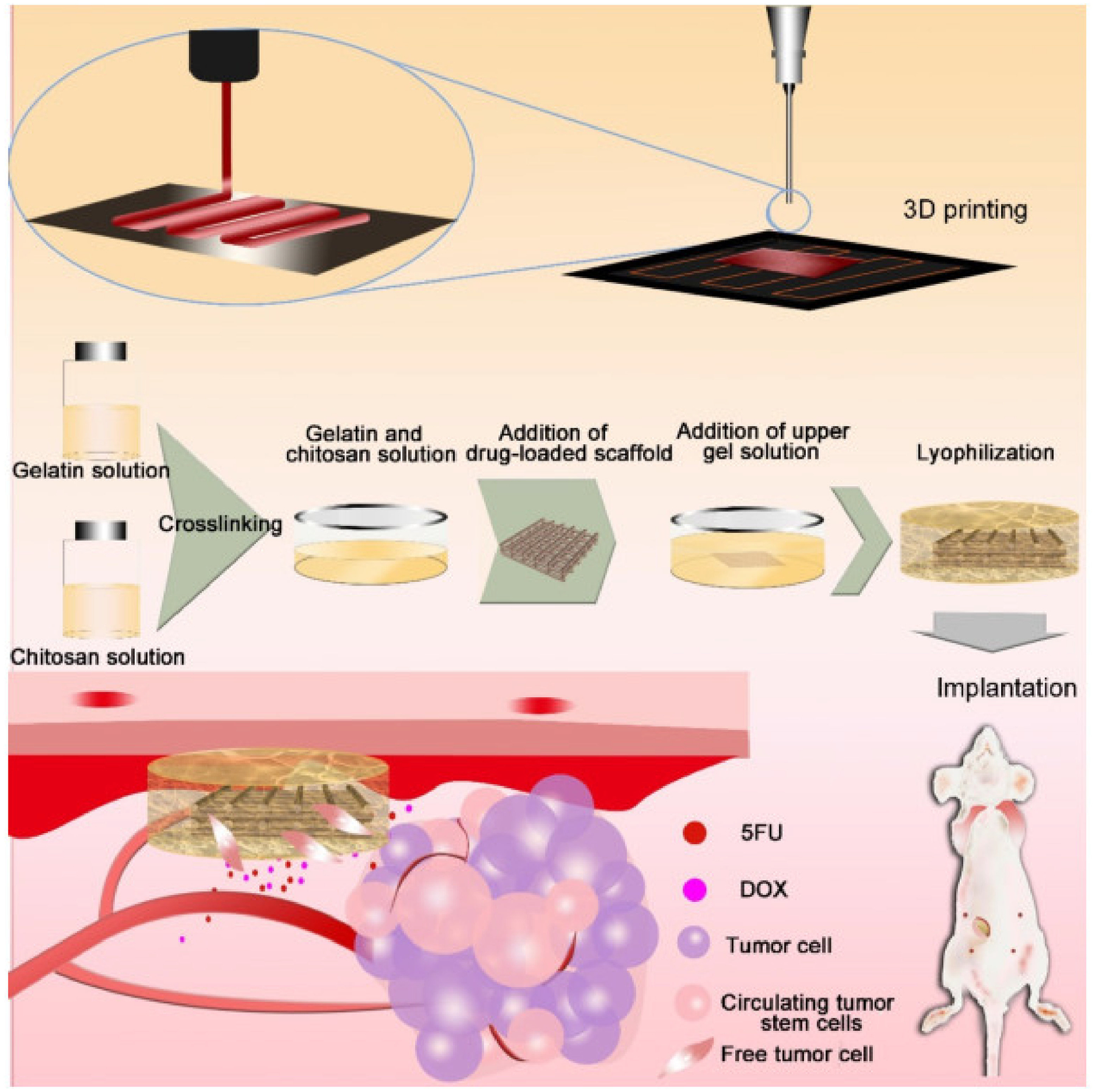 Implantable Devices for the Treatment of Breast Cancer.