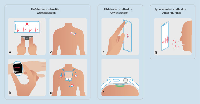 [Mobile health for detection of atrial fibrillation-Status quo and perspectives].