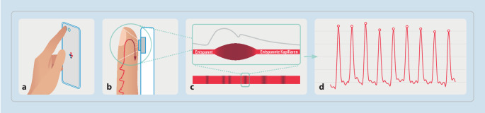 [Mobile health for detection of atrial fibrillation-Status quo and perspectives].