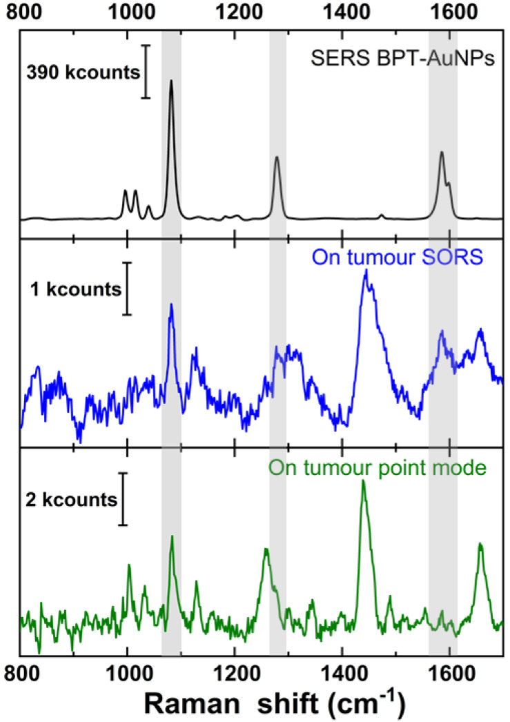 Surface enhanced deep Raman detection of cancer tumour through 71 mm of heterogeneous tissue.
