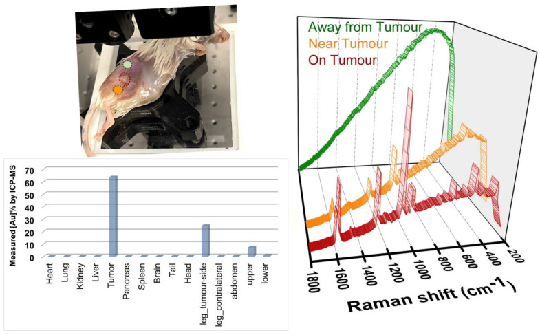 Surface enhanced deep Raman detection of cancer tumour through 71 mm of heterogeneous tissue.