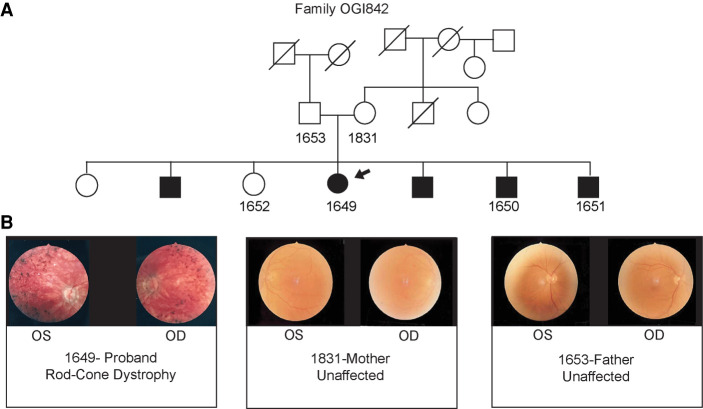 A hidden structural variation in a known IRD gene: a cautionary tale of two new disease candidate genes.