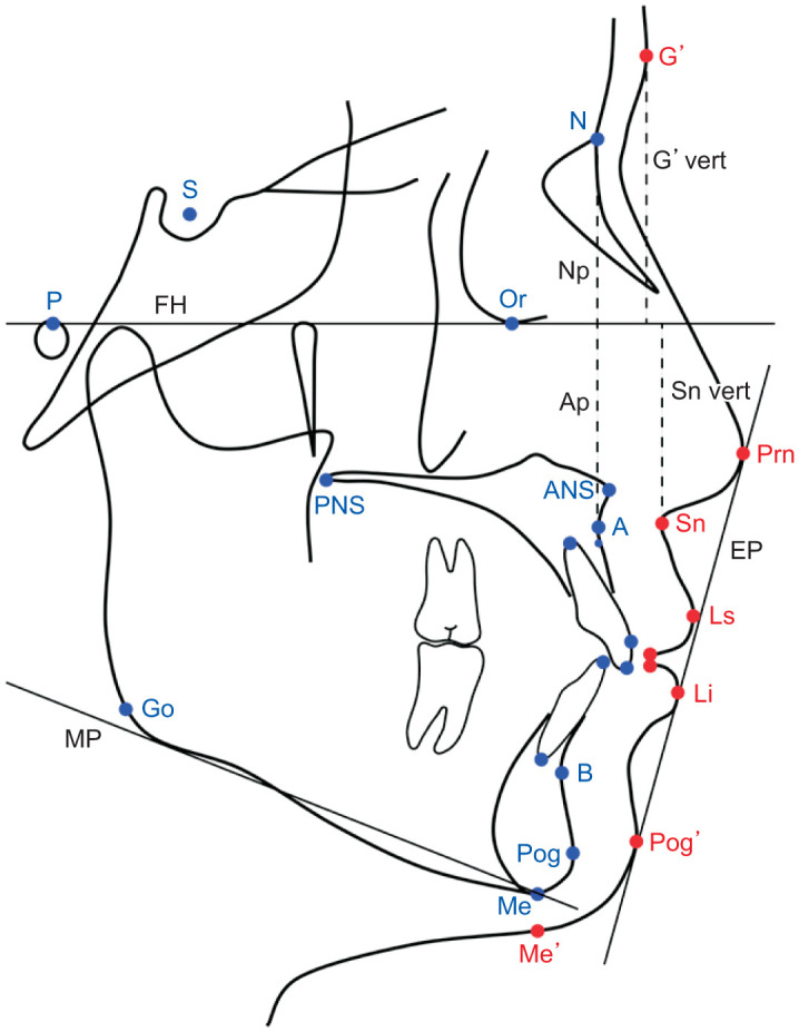 Customized maxillary incisor position relative to dentoskeletal and soft tissue patterns in Chinese women: A retrospective study.