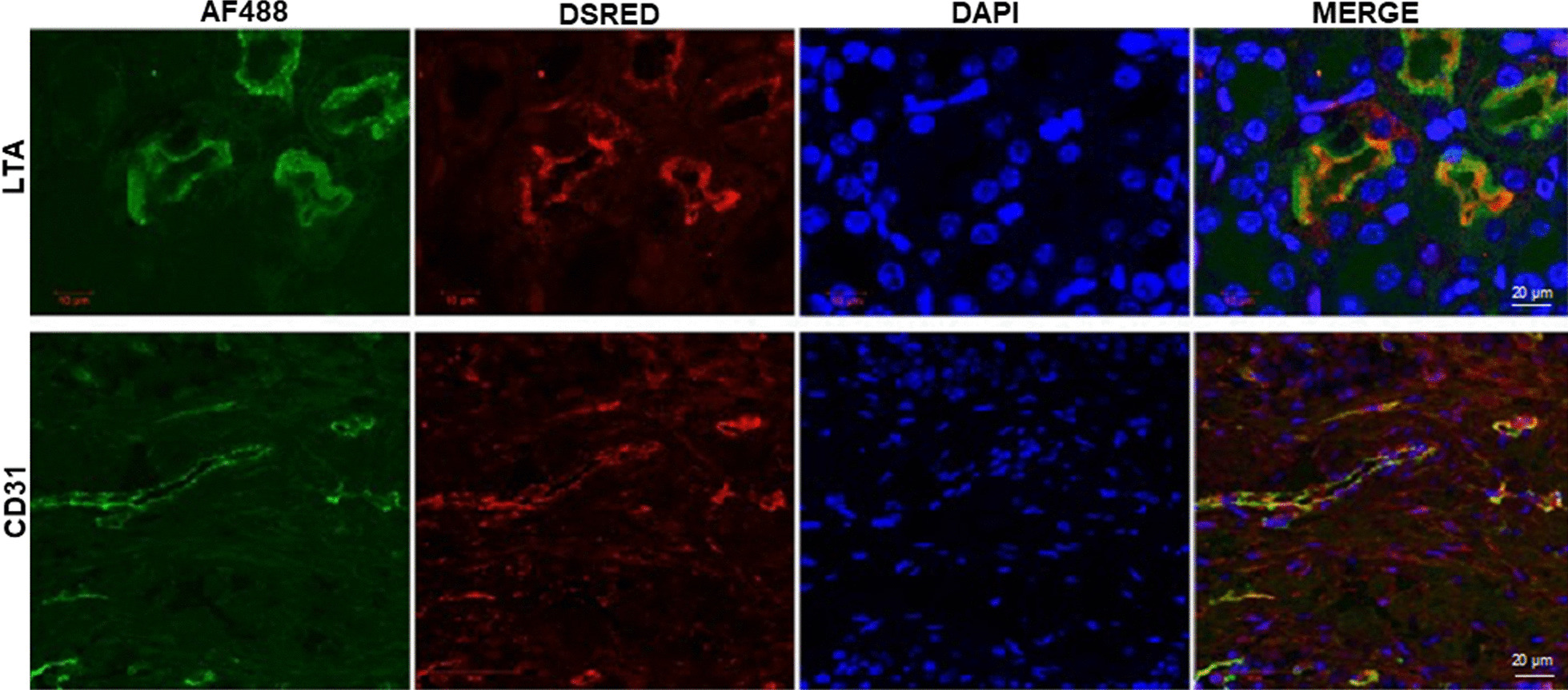 Therapeutic role of uterine-derived stem cells in acute kidney injury.
