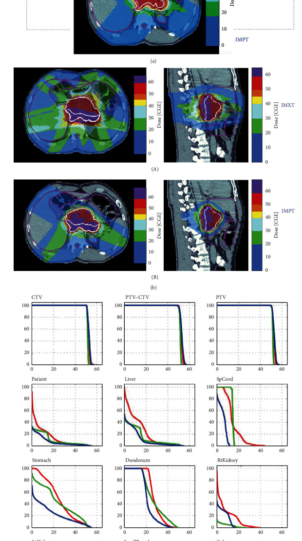 Comparison of 3D Conformal Proton Therapy, Intensity-Modulated Proton Therapy, and Intensity-Modulated Photon Therapy for Retroperitoneal Sarcoma.