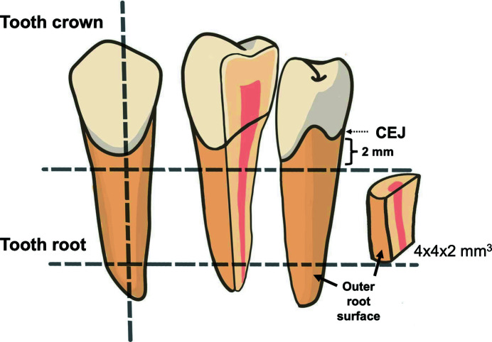 Synchrotron radiation analysis of root dentin: the roles of fluoride and calcium ions in hydroxyapatite remineralization.