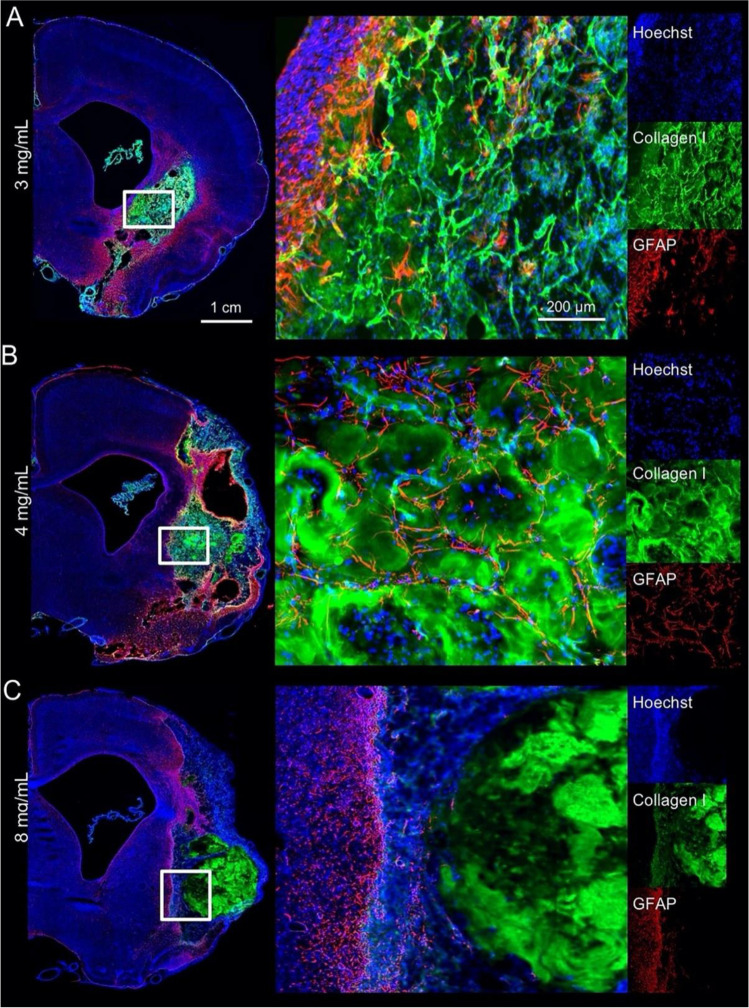 Emerging scaffold- and cellular-based strategies for brain tissue regeneration and imaging.