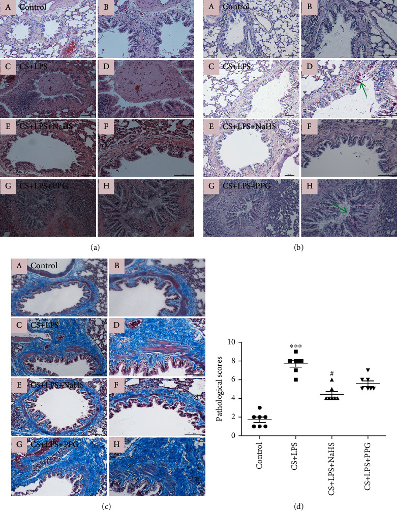 The Protective Role of Hydrogen Sulfide and Its Impact on Gene Expression Profiling in Rat Model of COPD.