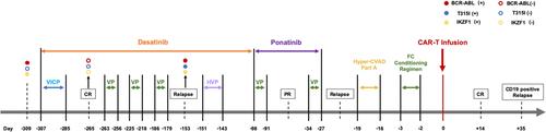 HLA-matched allogeneic anti-CD19 CAR-T therapy in treating a relapsed/refractory acute lymphoblastic leukemia patient with high tumor burden