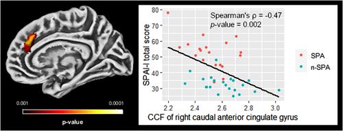 Cortical surface variation in individuals with excessive smartphone use