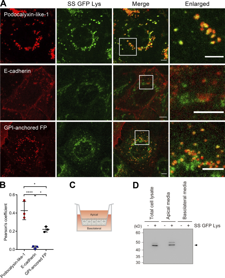 mTORC2 suppresses cell death induced by hypo-osmotic stress by promoting sphingomyelin transport.