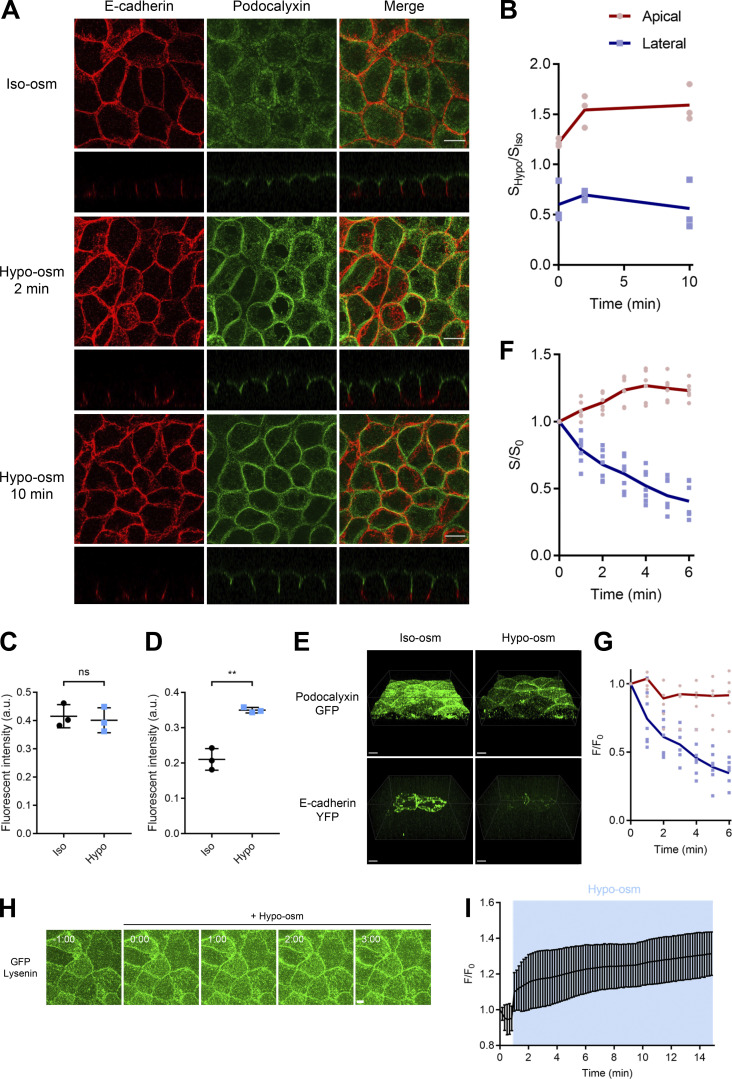 mTORC2 suppresses cell death induced by hypo-osmotic stress by promoting sphingomyelin transport.