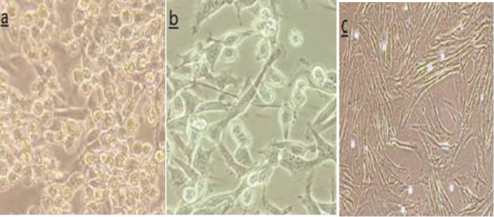 Assessment the Effect of Human Umbilical Cord Wharton's Jelly Stem Cells on the Expression of Homing Genes; CXCR4 and VLA-4 in Cell Line of Breast Cancer.