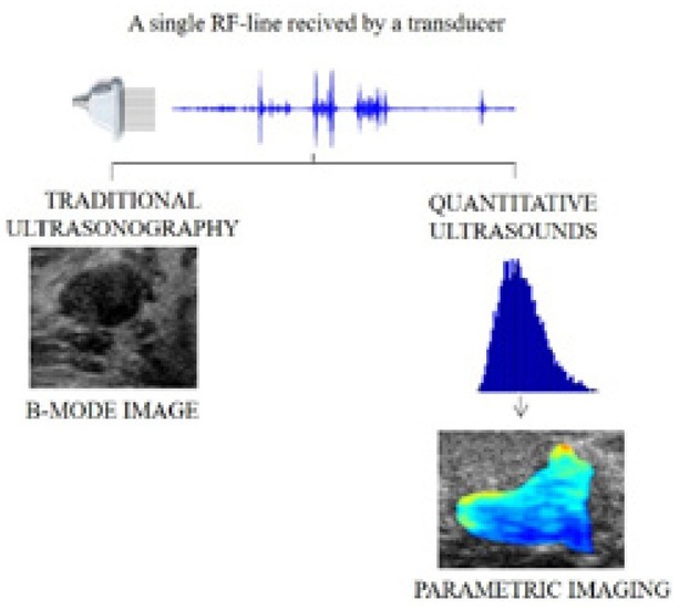 Quantitative Ultrasonography as a Tool for the Evaluation of Breast Tumor Response to Neoadjuvant Chemotherapy.