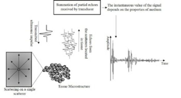 Quantitative Ultrasonography as a Tool for the Evaluation of Breast Tumor Response to Neoadjuvant Chemotherapy.