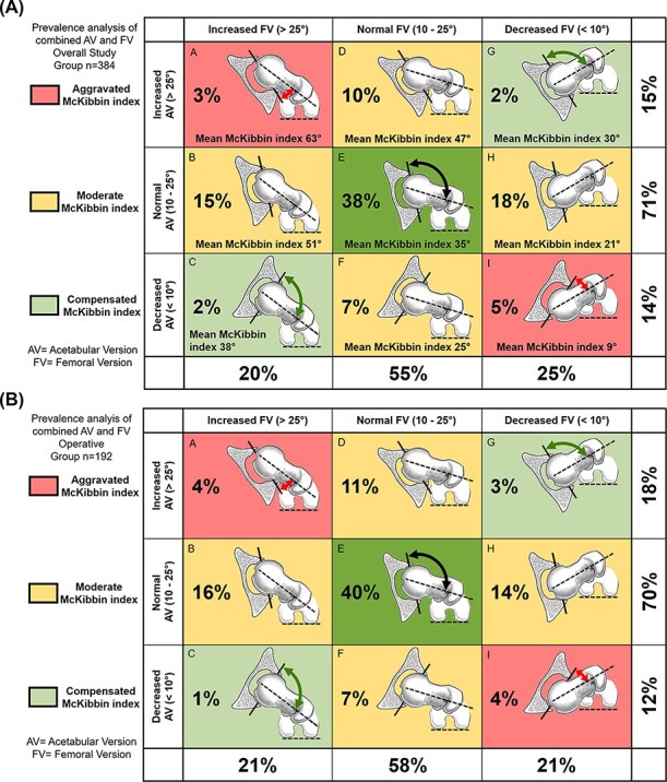 Combined abnormalities of femoral version and acetabular version and McKibbin Index in FAI patients evaluated for hip preservation surgery.