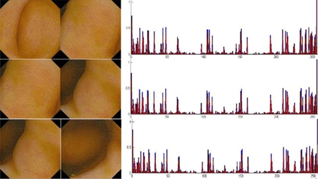 Similarity Analysis for Medical Images Using Color and Texture Histogramss.