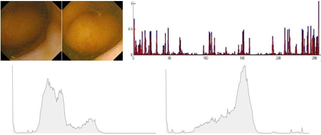 Similarity Analysis for Medical Images Using Color and Texture Histogramss.