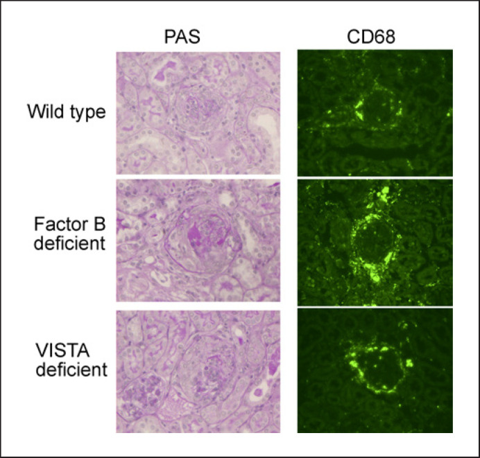 Experimentally Induced Anti-Myeloperoxidase Vasculitis Is Not Attenuated in Factor B or VISTA Deficient Mice.