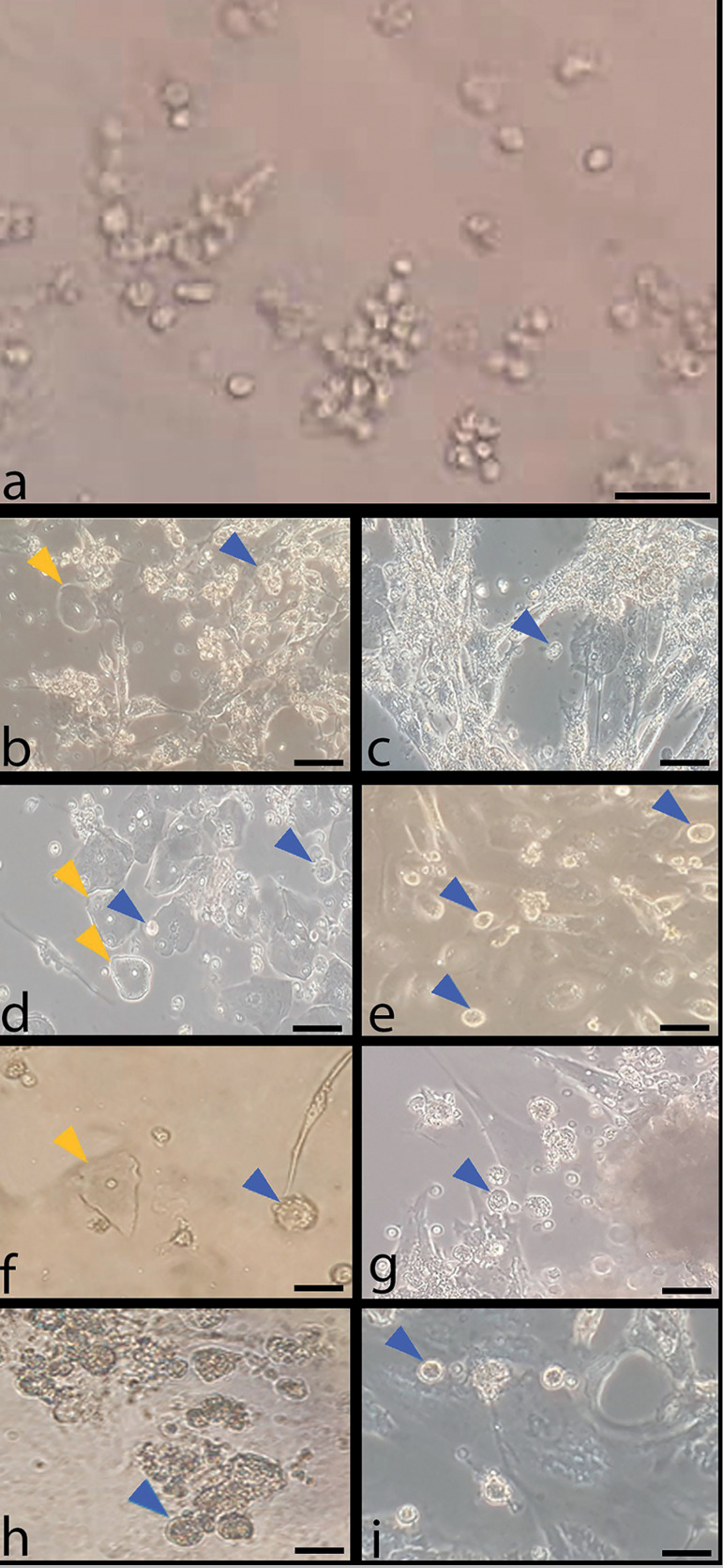 The Effect of Different Doses of Melatonin on in Vitro Maturation of Human Follicular Fluid-Derived Oocyte-Like Cells.
