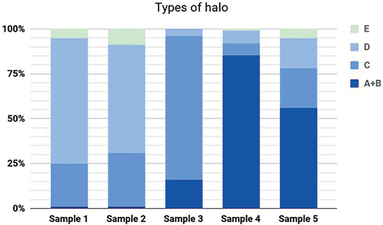 Association between terbinafine hydrochloride and sperm DNA fragmentation - case report.