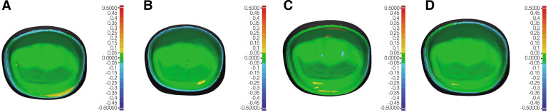 Evaluation of intaglio surface trueness, wear, and fracture resistance of zirconia crown under simulated mastication: a comparative analysis between subtractive and additive manufacturing.