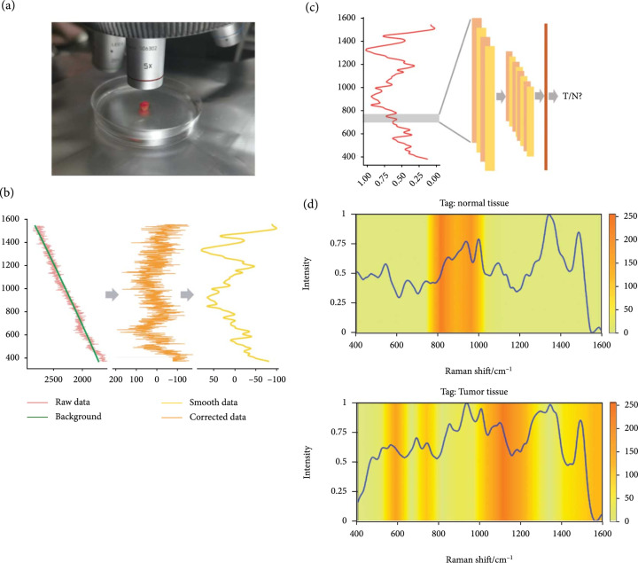 A Deep Learning Approach for Detecting Colorectal Cancer via Raman Spectra.