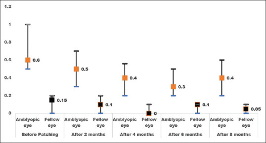 Treatment Outcome of Occlusion for Unilateral Amblyopia in Saudi Children 6-12 Years Old.