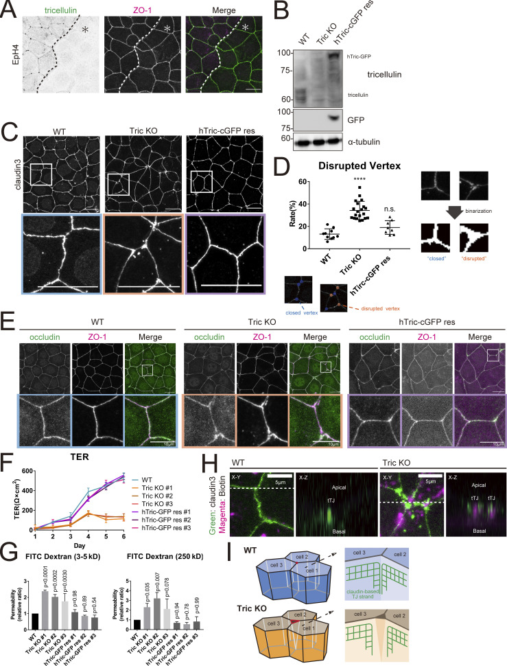 Tricellulin secures the epithelial barrier at tricellular junctions by interacting with actomyosin.
