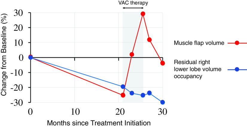 The Association of Vacuum-Assisted Closure Therapy with Dynamic Volume Change of a Muscle Flap Transposed in an Empyema Cavity for Chronic Empyema: A Case Report.