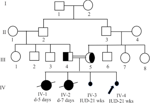 A Novel Familial Case Report of Genetic Syndrome Mimicking Congenital TORCH infections; Pseudo-TORCH Syndrome 2.