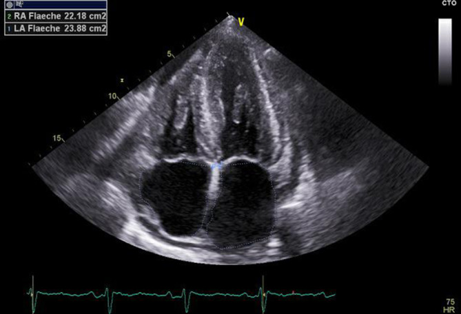 [68/m-Dyspnea, peripheral edema and weight loss : Preparation for the medical specialist examination: part 134].