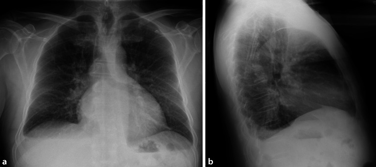 [68/m-Dyspnea, peripheral edema and weight loss : Preparation for the medical specialist examination: part 134].