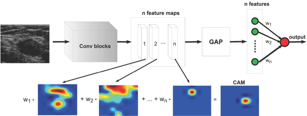 Explaining a Deep Learning Based Breast Ultrasound Image Classifier with Saliency Maps.