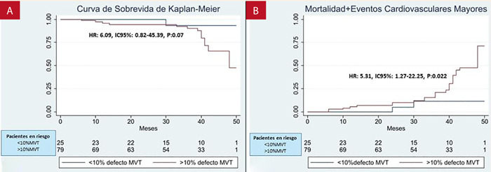 [Prediction of significant coronary lesions by SPECT myocardial perfusion. Results from a national reference hospital in Lima-Peru].