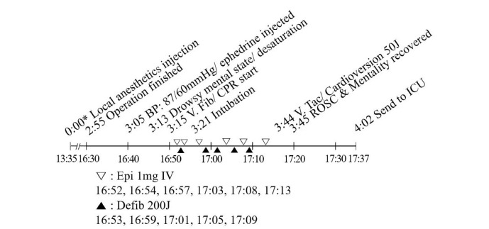 Two cases of late-onset cardiovascular toxicities after a single injection of local anesthetics during supraclavicular brachial plexus block - A report of two cases.