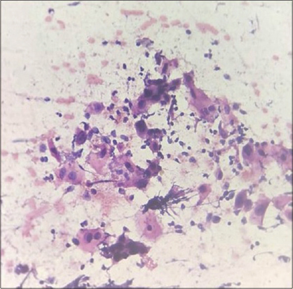 Association of Micronuclear Frequency with Dysplasia and Cytogenetic Changes (p53 Mutation and p16 Expression) in Oral Potentially Malignant Disorders.